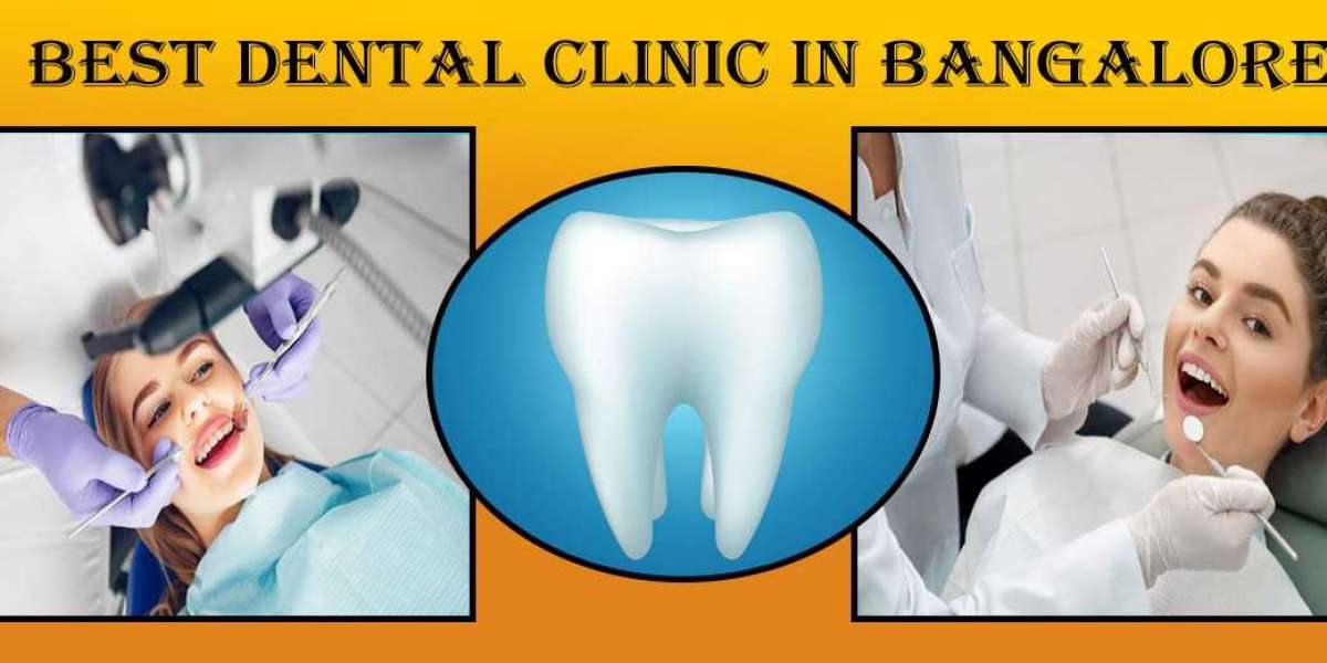 Best Dental Clinic in Bangalore | Dental Clinic in Bangalore