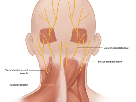 DR. AWSS ZIDAN | Headache and Pain Specialist