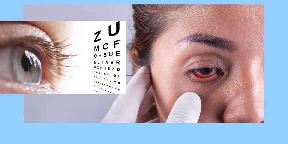 Why Choose the Eye Clinic in Kolkata for Glaucoma Treatment?
