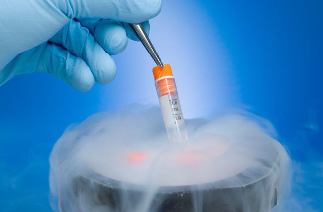 Egg Freezing and oocyte cryopreservation?