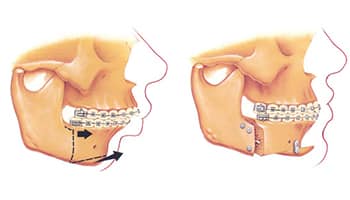 Best Oral and Maxillofacial Surgeon in Jalandhar