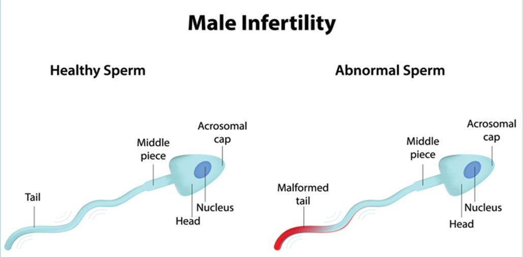 how to increase sperm count and motility naturally?