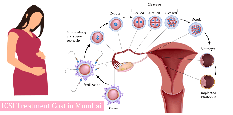 IVF treatment cost in Mumbai?