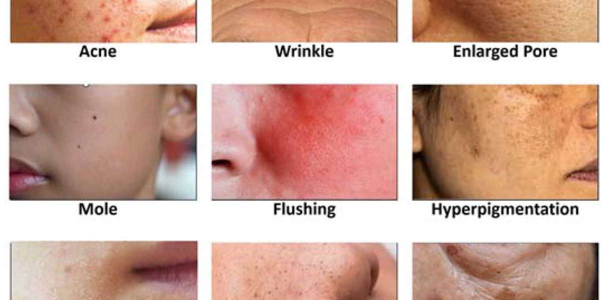 Useful Tips For Skin Problems