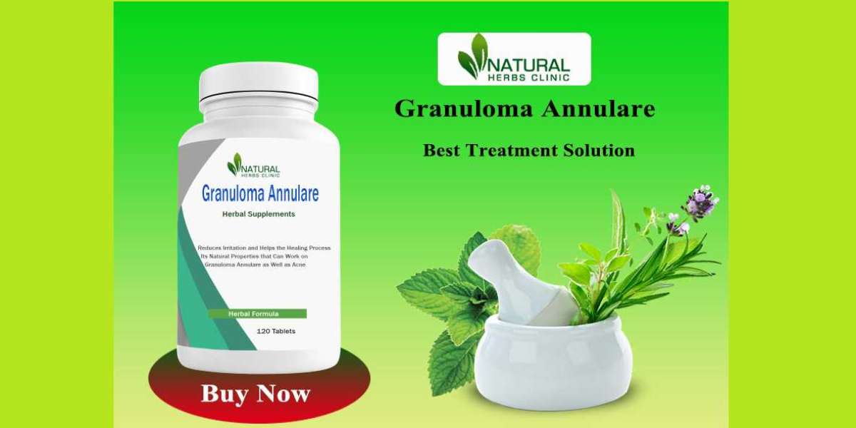 Natural Topical Treatments for Granuloma Annulare: Essential Oils, Aloe Vera, and More