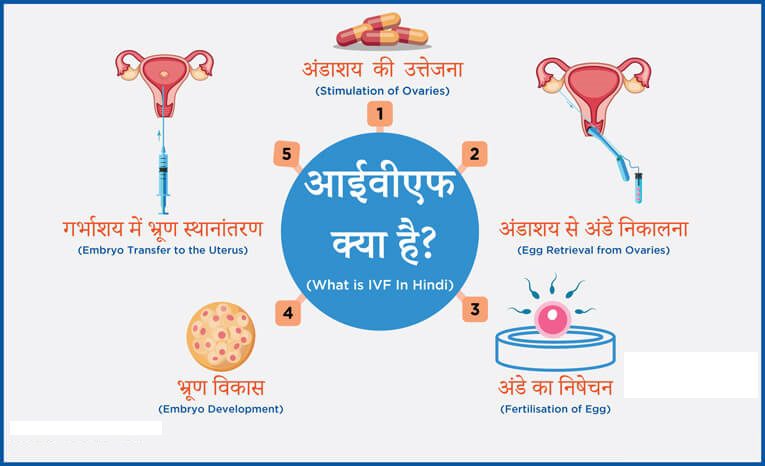 What is IVF in Hindi?-IVF Means in Hindi - आई वी एफ क्या है?