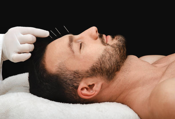 Floreat Acupuncture — Exploring the Benefits of Acupuncture in Perth:...