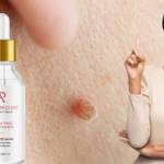 Amarose Skin Tag Remover Profile Picture