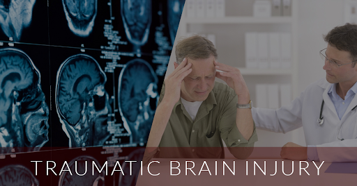 Los Angeles Brain Injury Attorney | Your Guide In Complex Brain Injury Cases