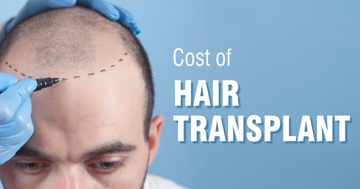 What Factors Affect Hair Transplant Cost?