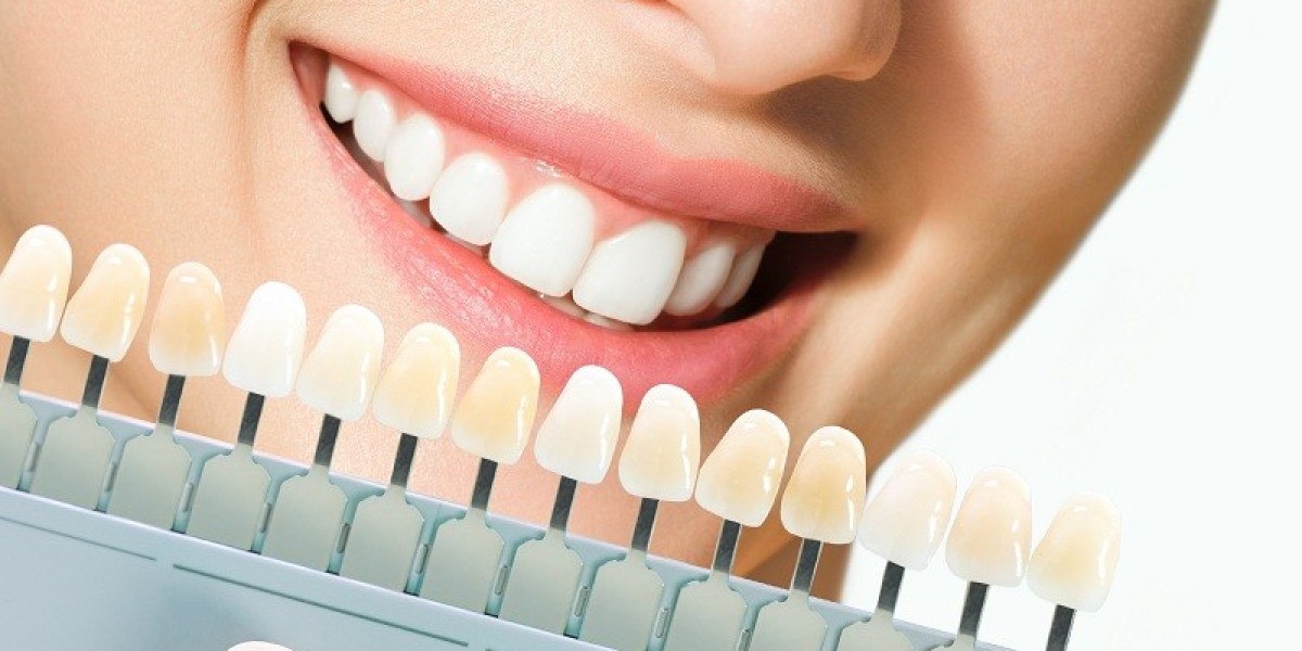 The Benefits of Cosmetic Dentistry in Etobicoke - Elevating Your Smile's Radiance