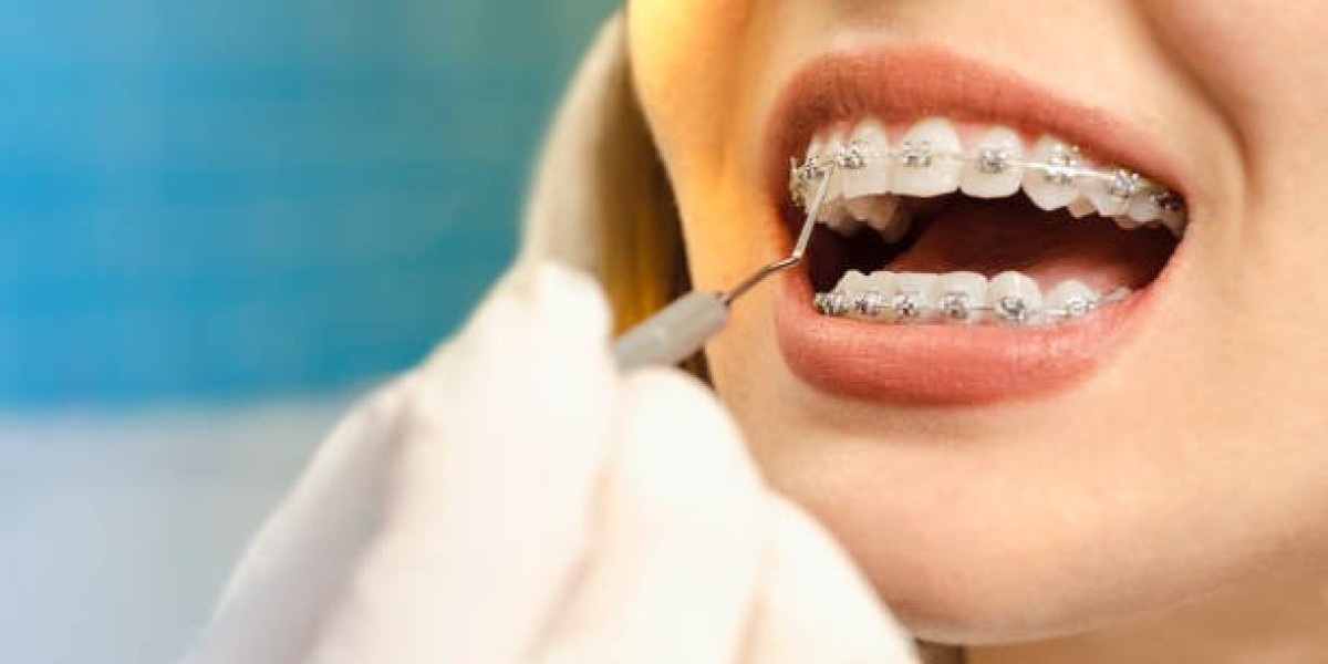 Invisalign for Adults: Why It's Never Too Late to Achieve a Beautiful Smile