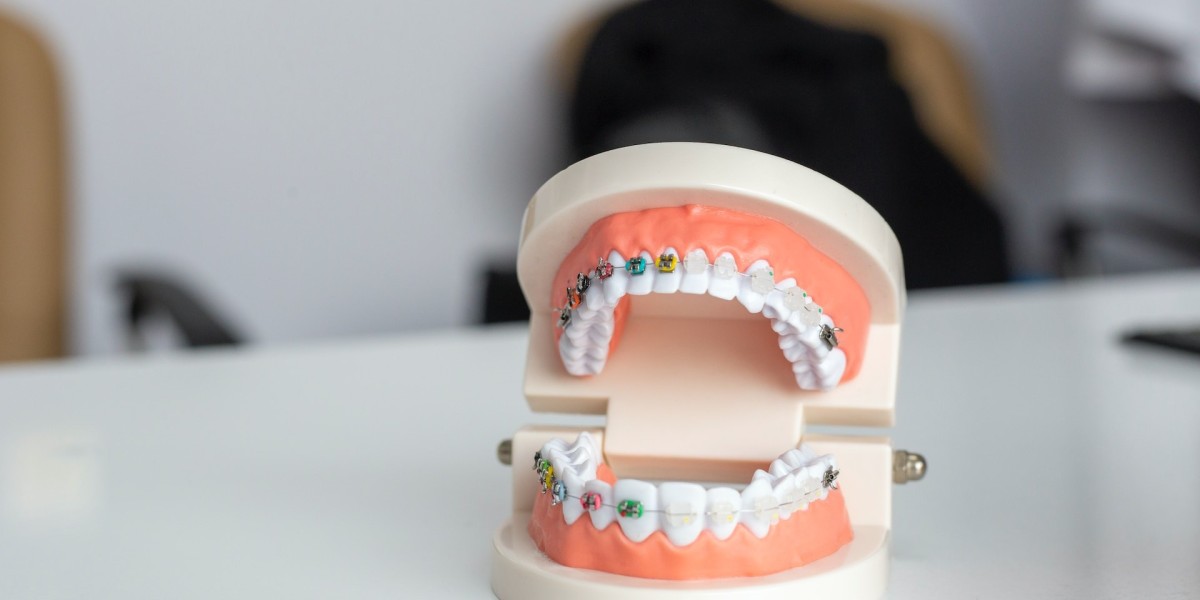 Navigating Dental Transformations: Unveiling Invisalign Cost and Teeth Braces Price in Pakistan