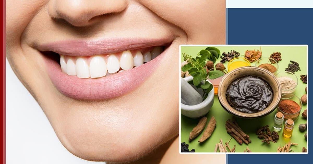 How To Avoid Root Canal By Ayurveda