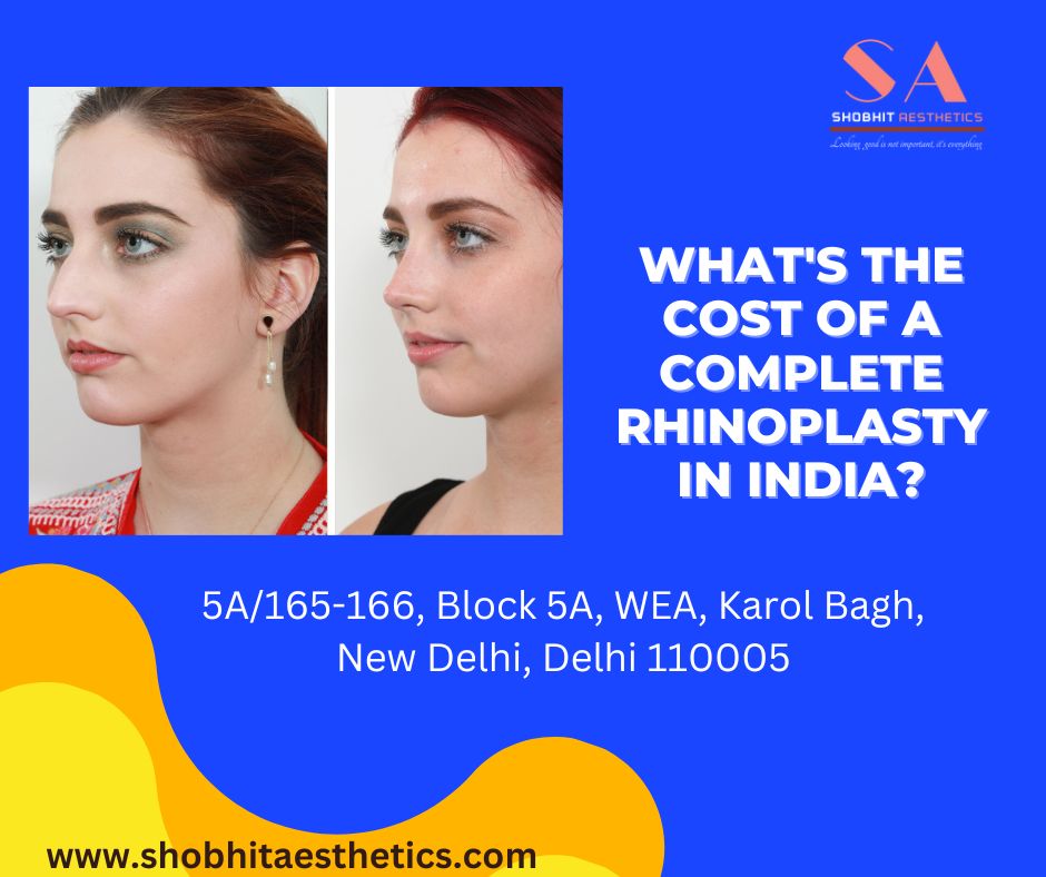 What's the cost of a complete rhinoplasty in India? - Topbloginc.com