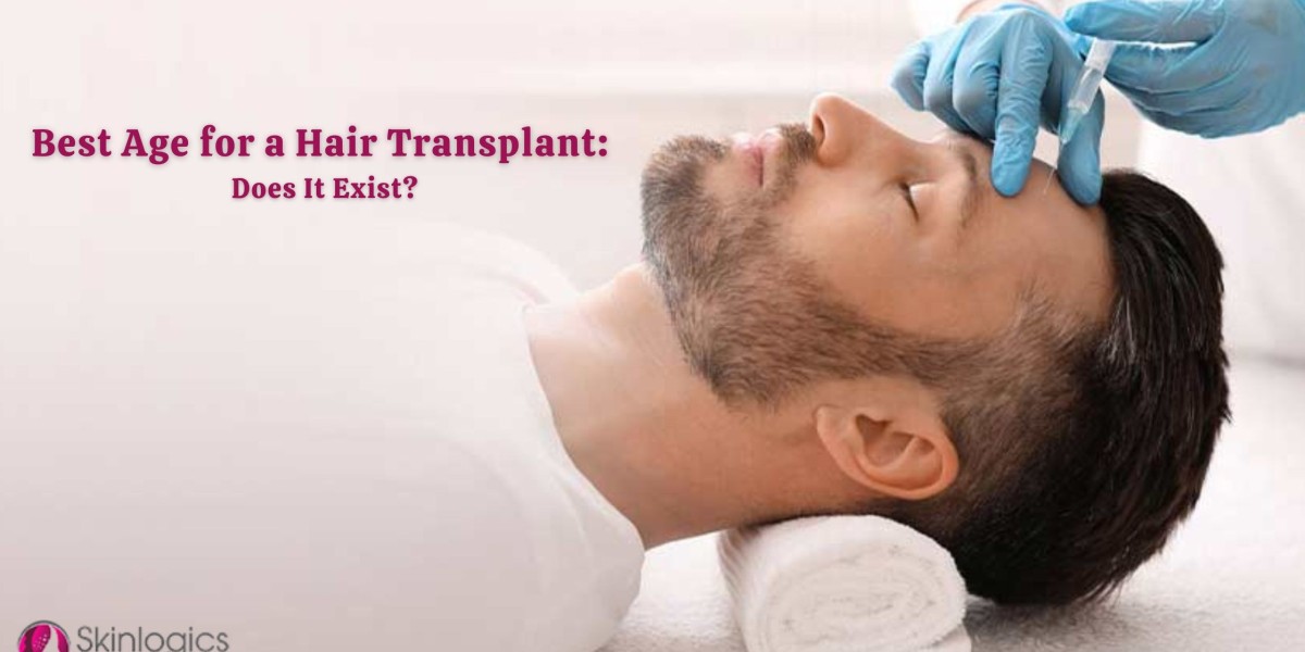 Best Age for a Hair Transplant: Does It Exist?