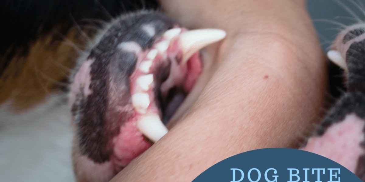 Negligence vs. Strict Liability in Dog Bite Cases: What's the Difference?