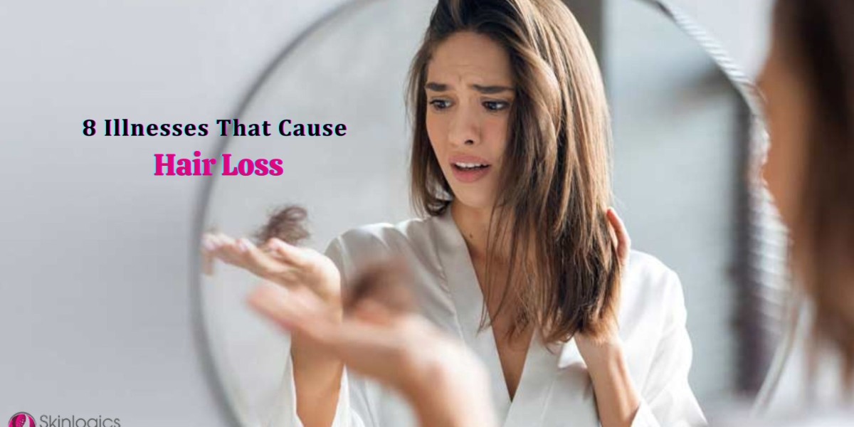 8 Illnesses That Cause Hair Loss