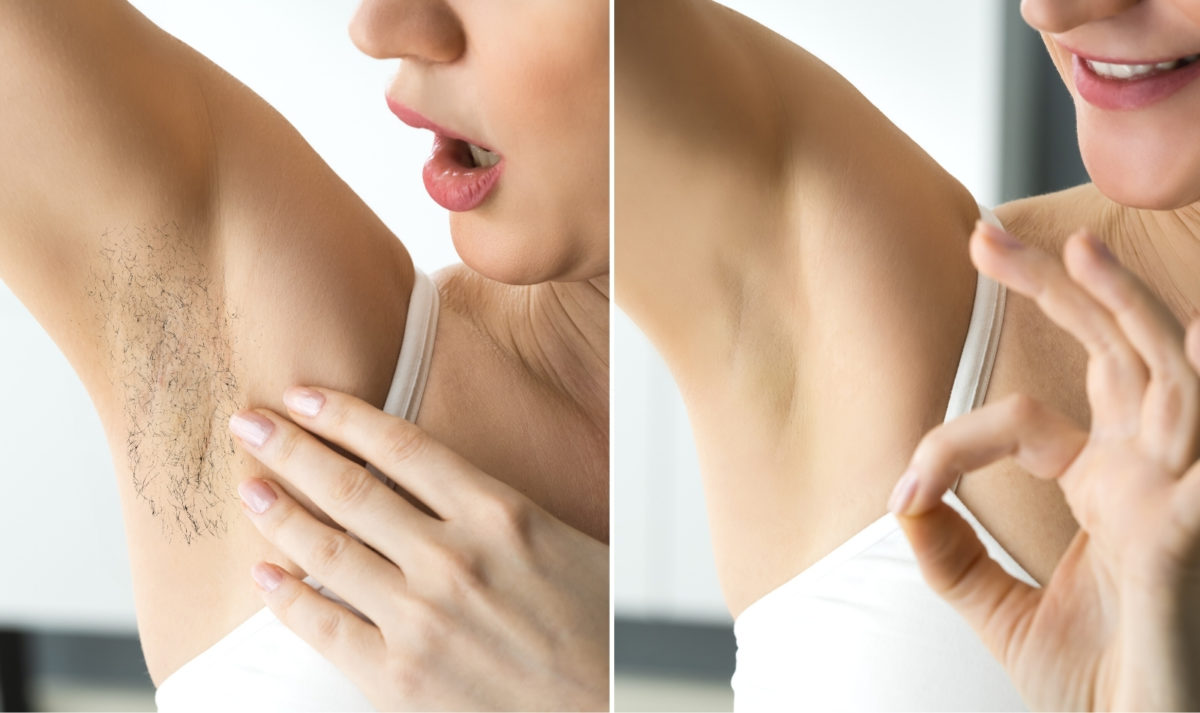 Why Most Women Opt for IPL for Body Hair Removal? - Boss Techie