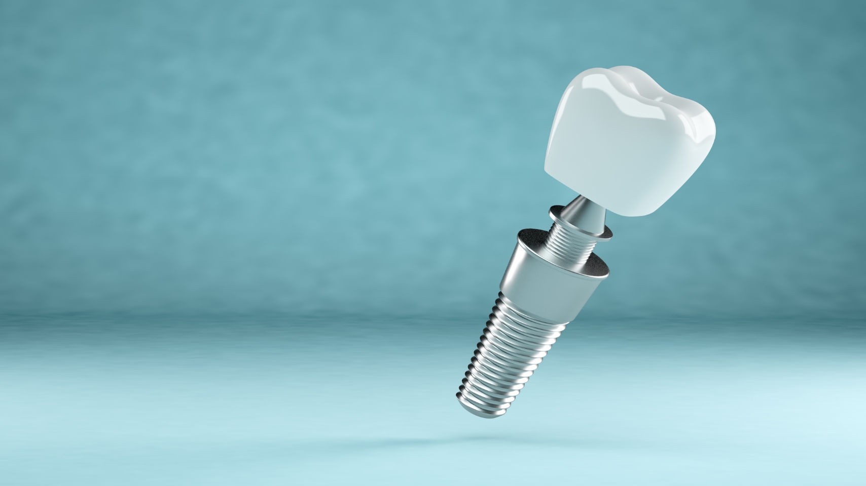 Best Dental Implants Bali, Dental Clinic - kalmdentalcare.com