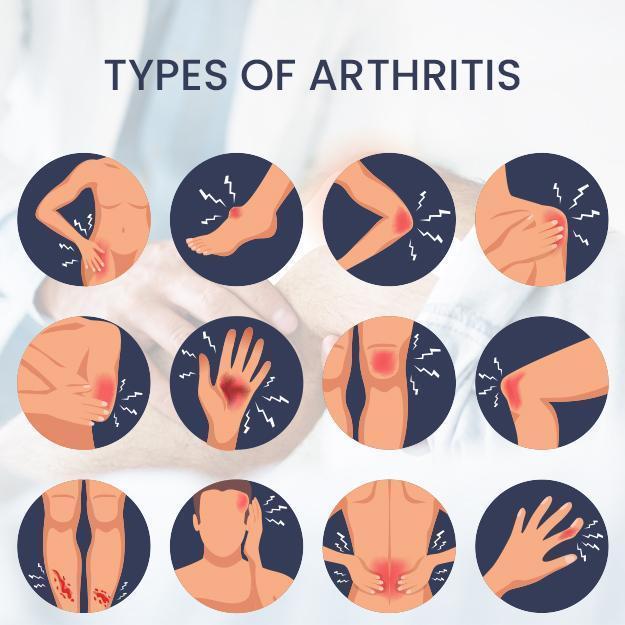 Arthritis and Joint Pain - Cincinnati Ohio Chiropractor