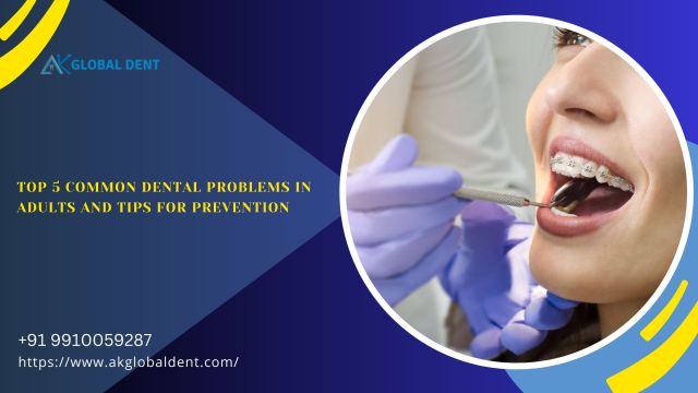 AK Global Dent on Tumblr: Will the Braces Help With Teeth Grinding?