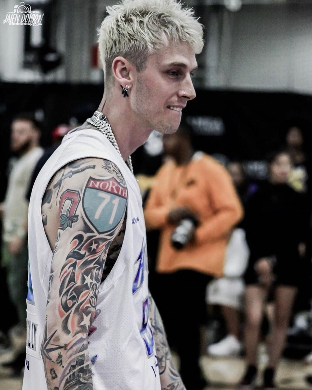 Machine Gun Kelly's Hair Transplant: A Story of Self-Expression