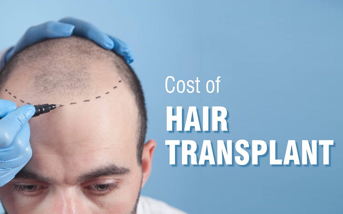 Factors Deciding the Cost of Hair Transplant in Mumbai- Surgeon Guide | by Dr. Sumit Agrawal | Feb, 2024 | Medium