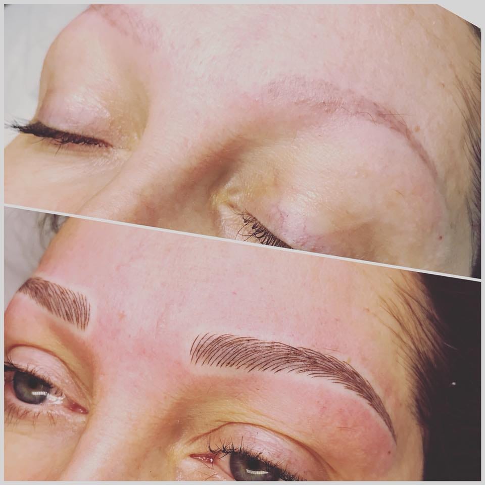 Unlocking The Flawless Beauty With Eyebrow Microblading in London | by London Aesthetics Clinic | Feb, 2024 | Medium