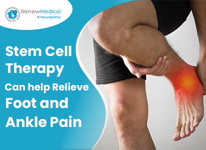 Stem Cell Therapy can help relieve foot and ankle pain.