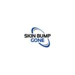 Skin Bump Gone Profile Picture