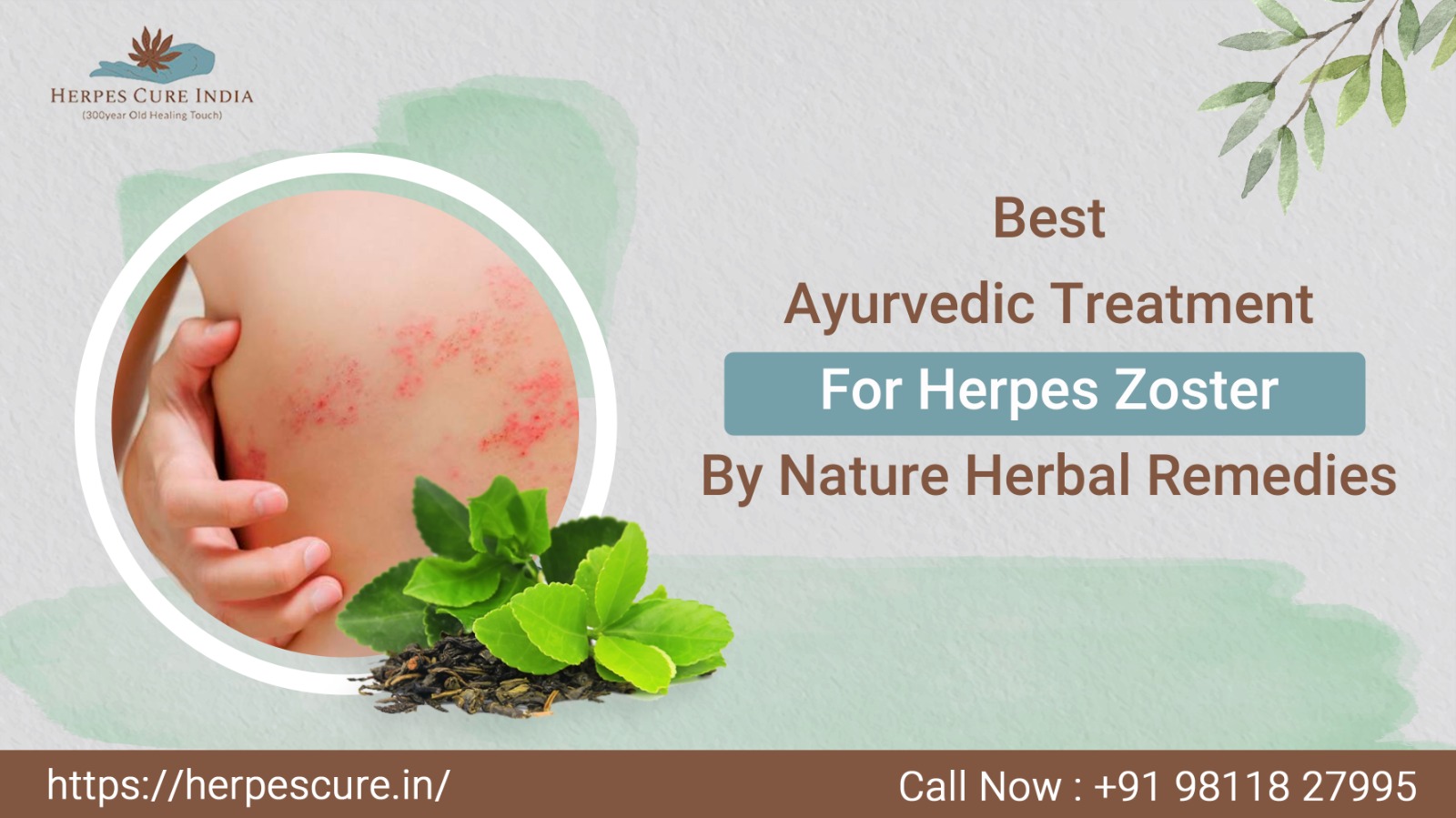 Best Ayurvedic Treatment For Herpes Zoster by Nature Home Made Oil's