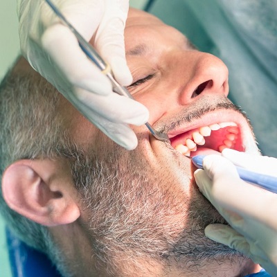 Root Canal Treatment in Islamabad Pakistan - ERCs