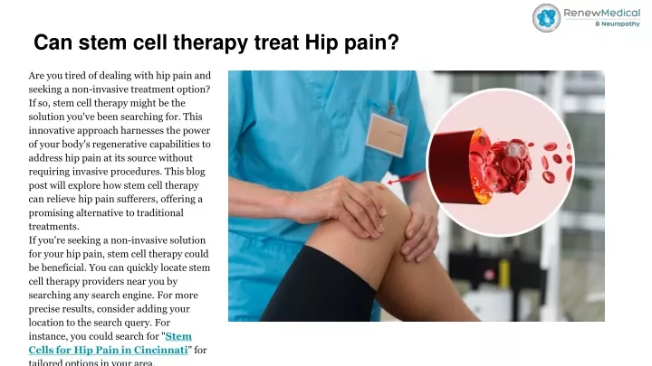 PPT - Can stem cell therapy treat Hip pain_ PowerPoint Presentation, free download - ID:12986826