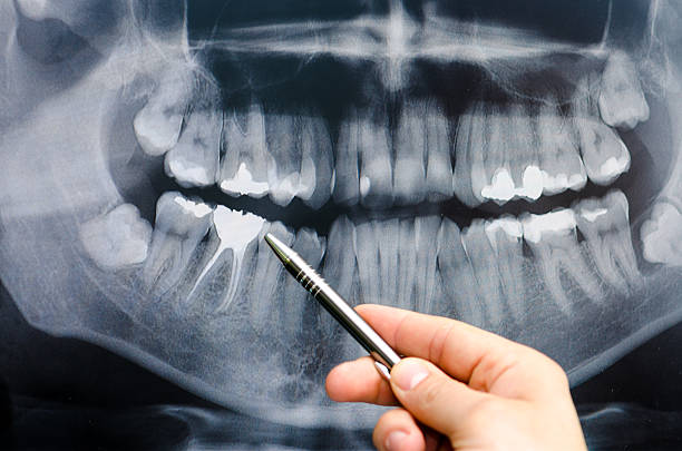 Unlocking Affordable Dental Care: Group Dental Plans in Tampa | TheAmberPost
