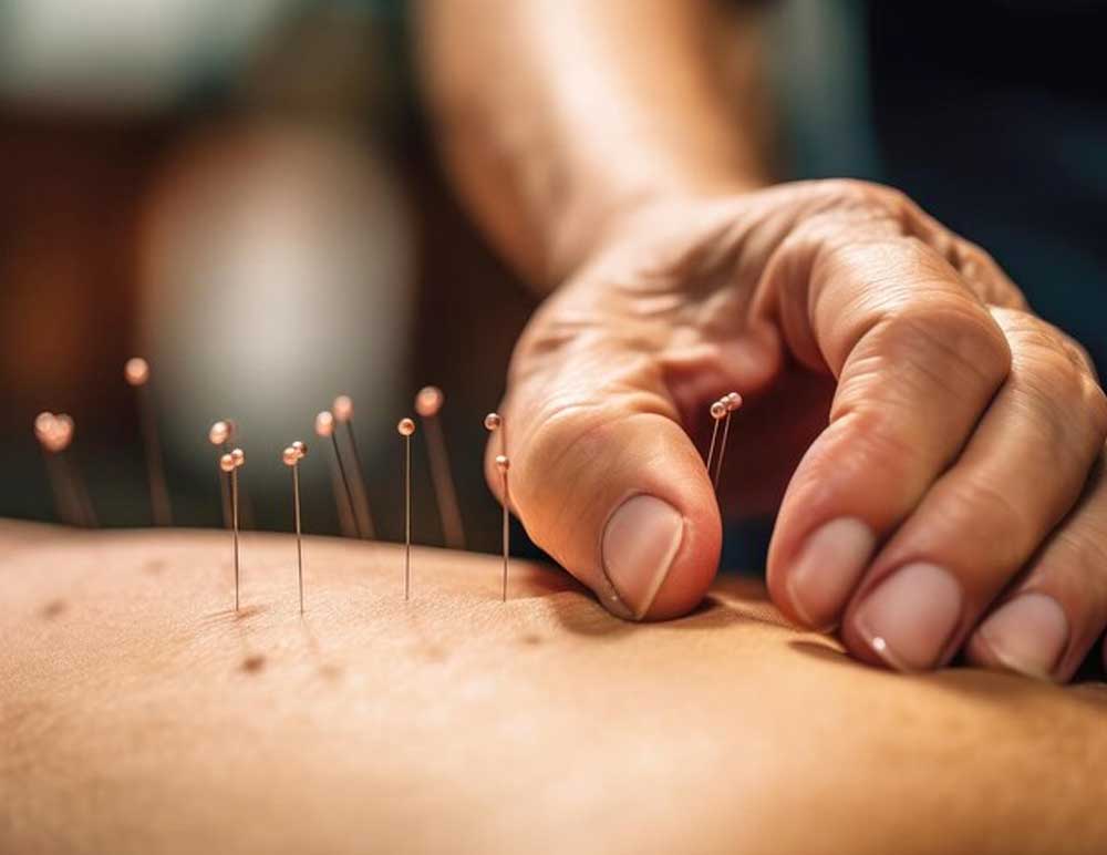 Acupuncture for Pain Management - Yang Orlando Acupuncture