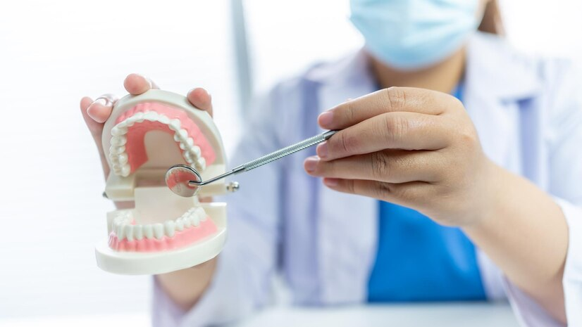 Dental Implants - The Modern Solution to Missing Teeth