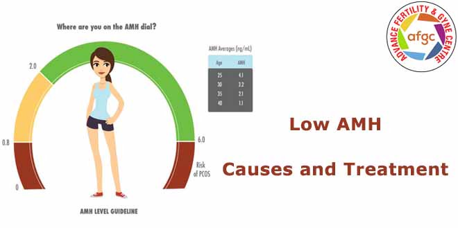 Effective Treatment for Low AMH Levels | Discover Causes and Solutions | Advance Fertility & Gynecology Centre