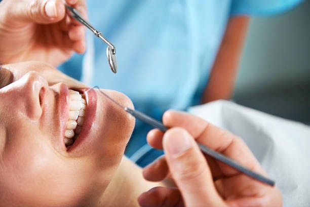 The 4 Exceptional Advantages of Getting Veneers