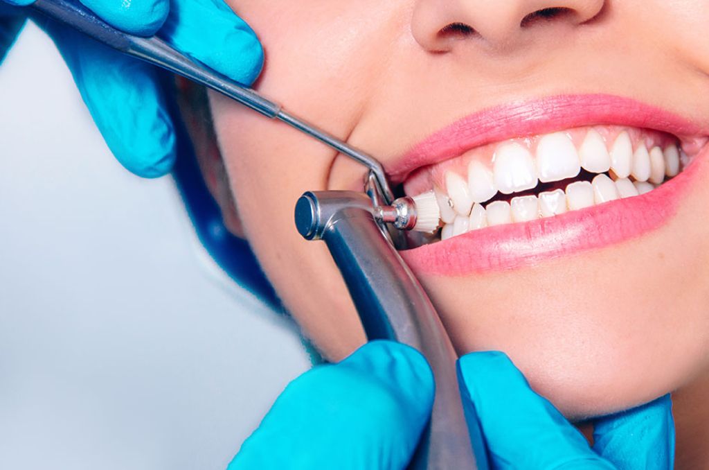 Teeth Cleaning in Borivali West - Roosh Dental Clinic