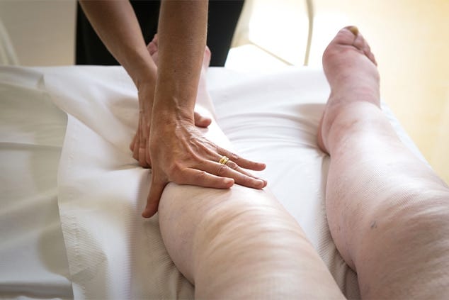 Lymphedema Home Care Therapy in Florida Augments Faster Healing of Patients | by Axiom Health Management | Jul, 2024 | Medium