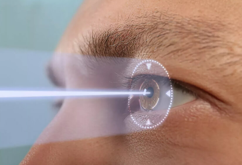 Can Lasik Surgery Be Done Twice?