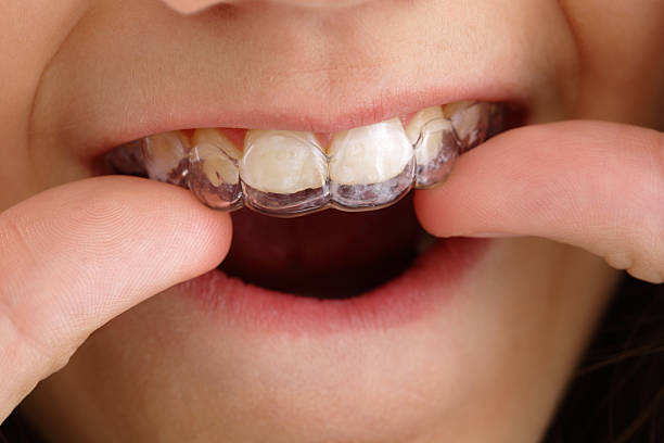 How Early Orthodontics for Youngsters Can Help Them in The Future | Surf City Orthodontics