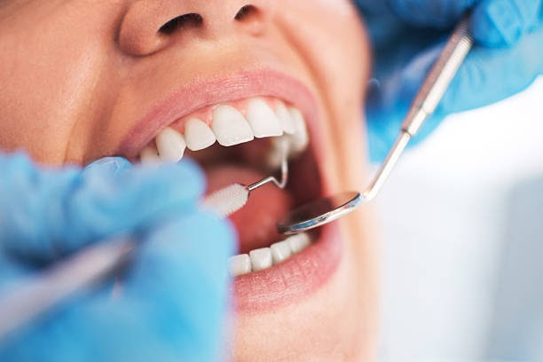 Your Local Dentist - Services You Can Expect from Them