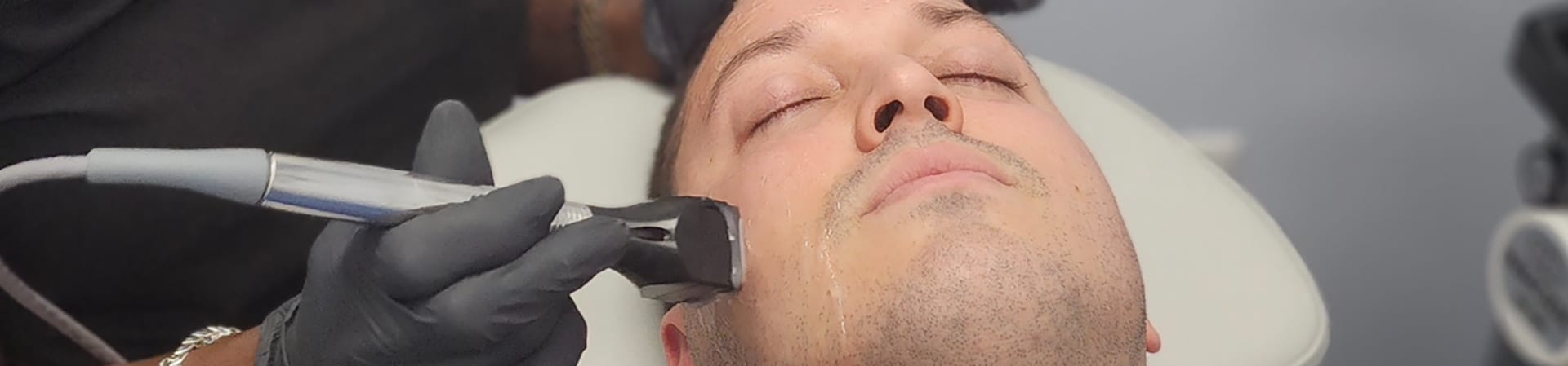 Forma Radiofrequency Treatment Cortlandt - Hudson Aesthetics