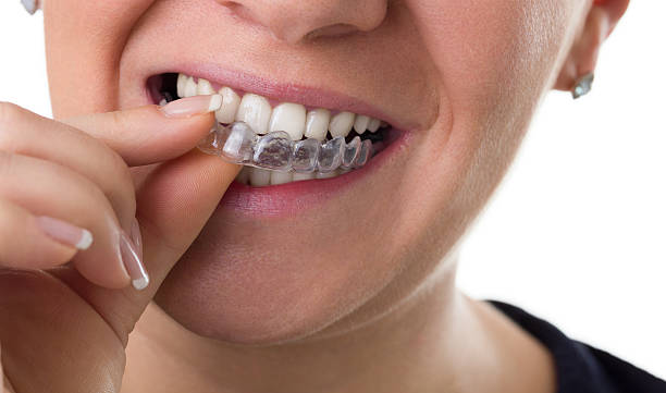 Life During Orthodontic Treatment | TheAmberPost