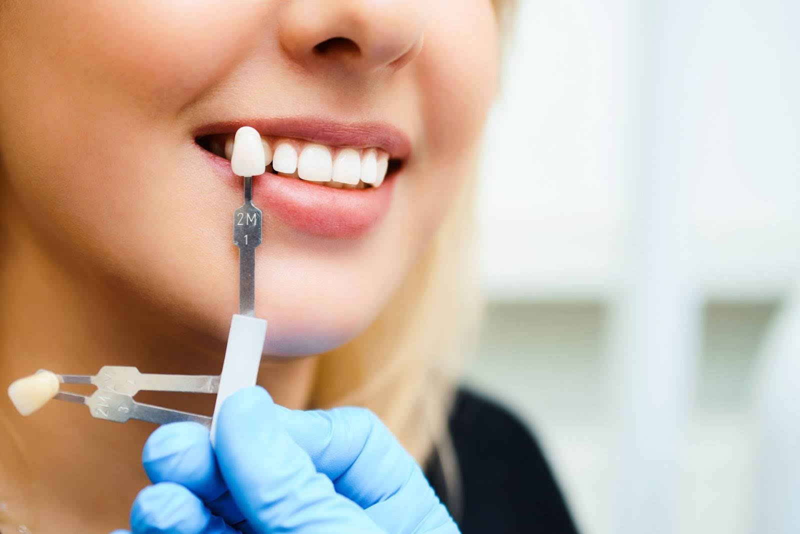 Everything You Need to Know About Dental Implants in Miami