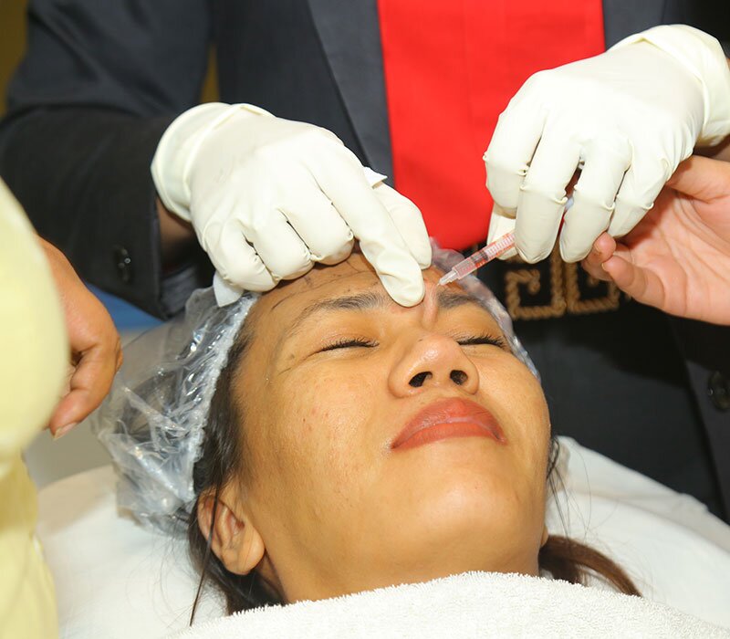 Best Botox Treatment: Expert Solutions for a More Radiant You