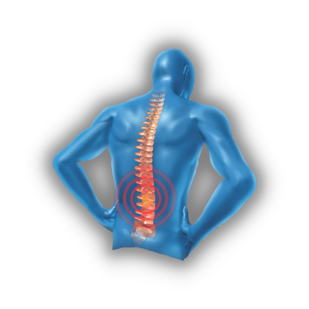 Physical Therapy for Back Pain Relief - Marcel Jacobs PT