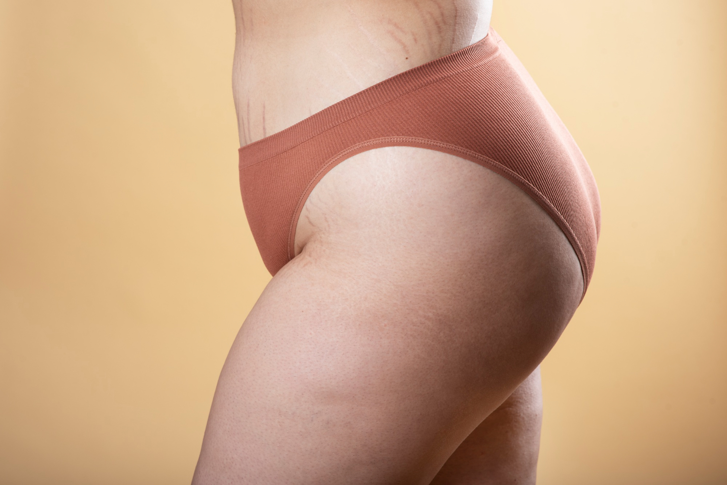 Sculptra Butt Lift in Sacramento, CA - Sculptra BBL | Aesthetic ENVY